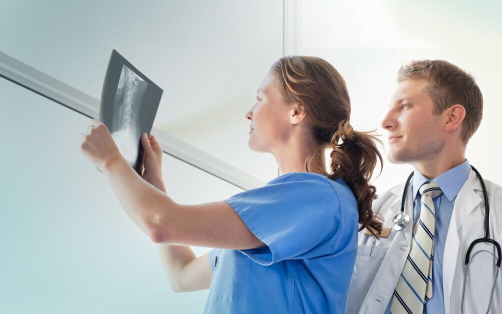 лекари, които гледат рентгенова снимка за артроза